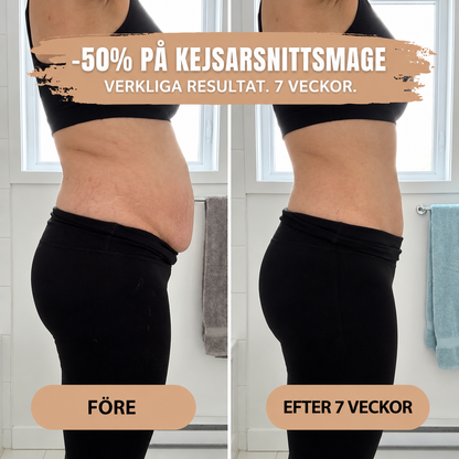 The Women™ Förlossningstrosor – 360° Formande Stöd