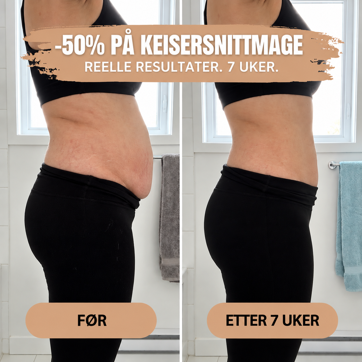 The Women™ Barseltruse – 360° Formende Støtte